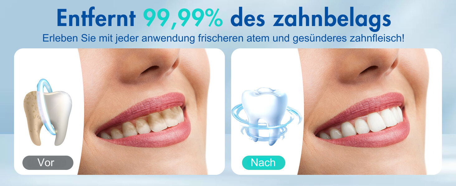 Електрична ірigator для порожнини рота BarberBoss QR-7024 (білий/чорний) - 5 режимів, 5 насадок