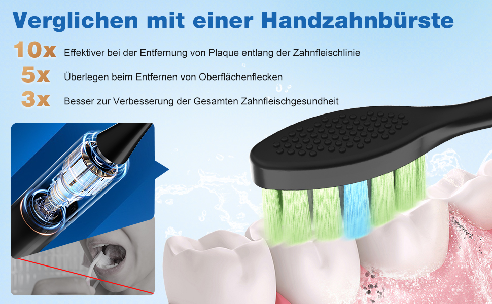 Електрична звукова зубна щітка, 45000 VPM, відбілювання за 1 тиждень, 120 днів роботи від акумулятора, індикатор заряду, 6 насадок DuPont, 5 режимів, таймер, чорна