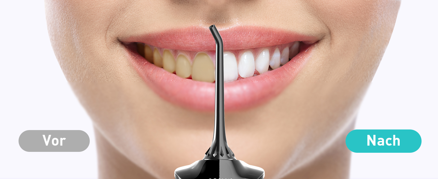 COSLUS Бездротовий електричний іригатор для порожнини рота: 4 режими, портативний, бак 300 мл, з очищувачем язика, для догляду за зубами та подорожей (світло-зелений/світло-чорний)