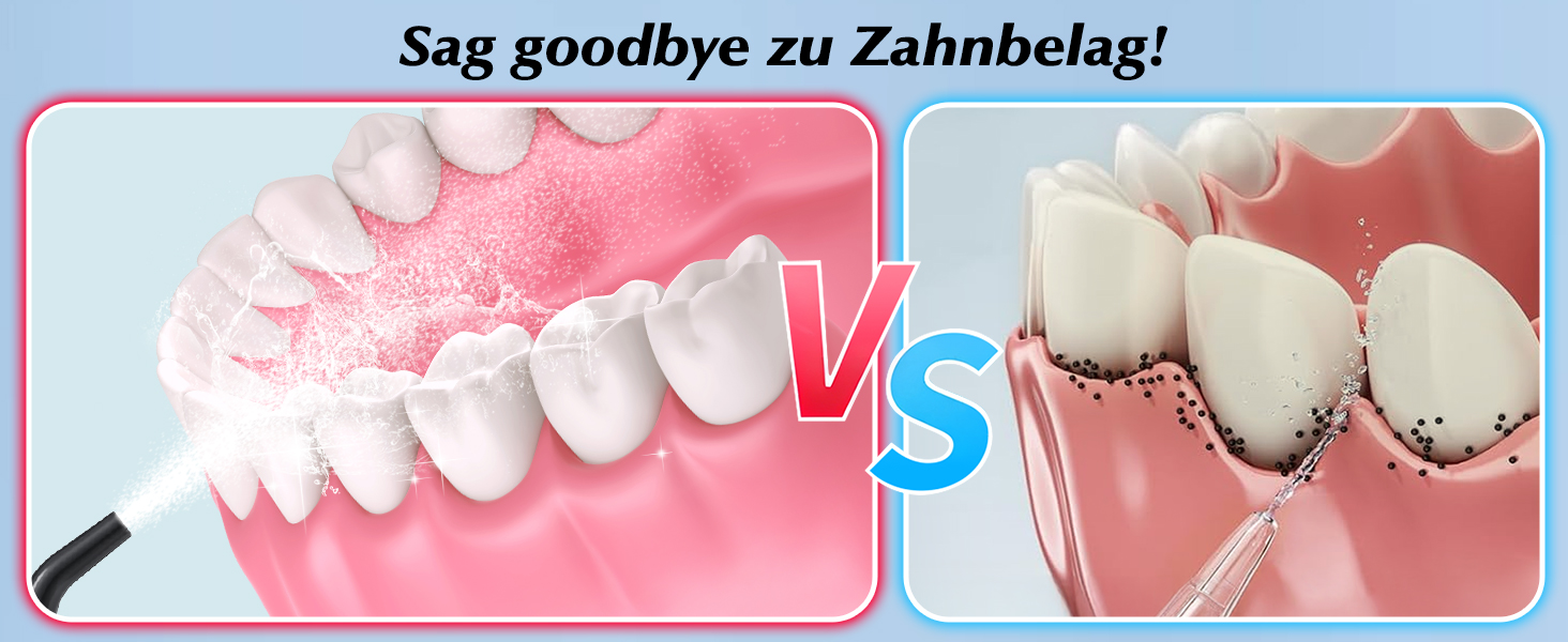 Електрична насадка для душу Munddusche: 5 струменів, 4 режими, для догляду за порожниною рота, водонепроникність IPX7, для дому та подорожей