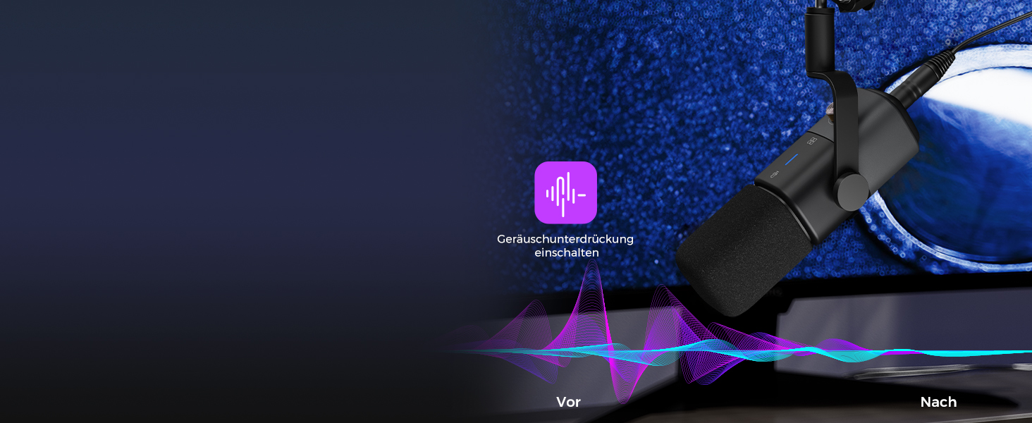NearStream AM15X: Динамічний мікрофон для ПК, XLR/USB, для подкастів, стрімінгу та студійних записів