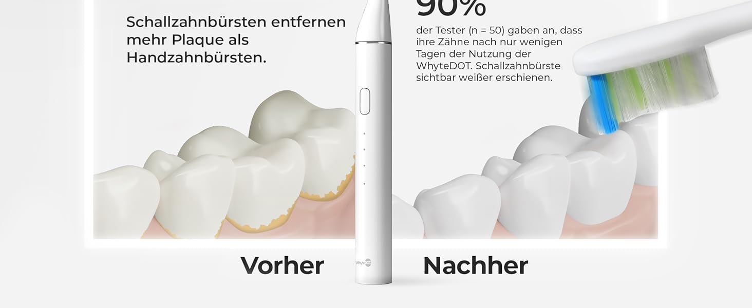 Звукова зубна щітка WhyteDOT® Premium: тиха, ефективна, з алюмінієвим корпусом, UV-футляром та до 6 тижнів роботи