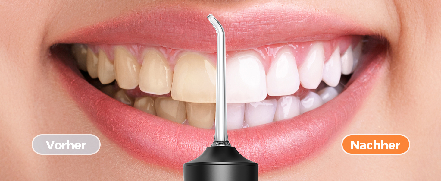 Ірригатор для порожнини рота Operan Munddusche Black - бездротовий, портативний, 300 мл, 4 насадки