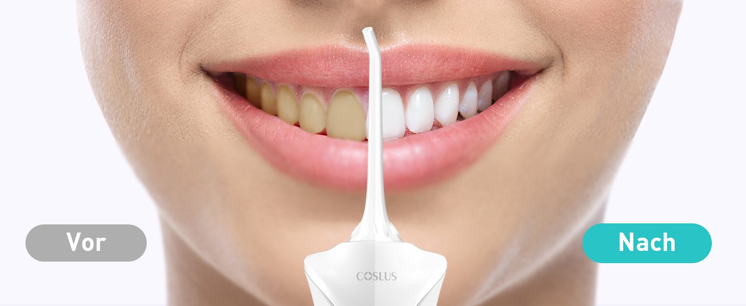 COSLUS Бездротовий електричний іригатор для рота: 4 режими, портативний, 300 мл резервуар, тестер-переможець, легкий у використанні, скребок для язика, догляд за зубами, для подорожей, світло-зелений (білий)