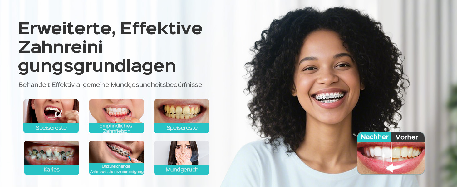 Портативна електрична душова насадка COSLUS: 300 мл, IPX7, 5 насадок, для догляду за порожниною рота, білий (чорний)