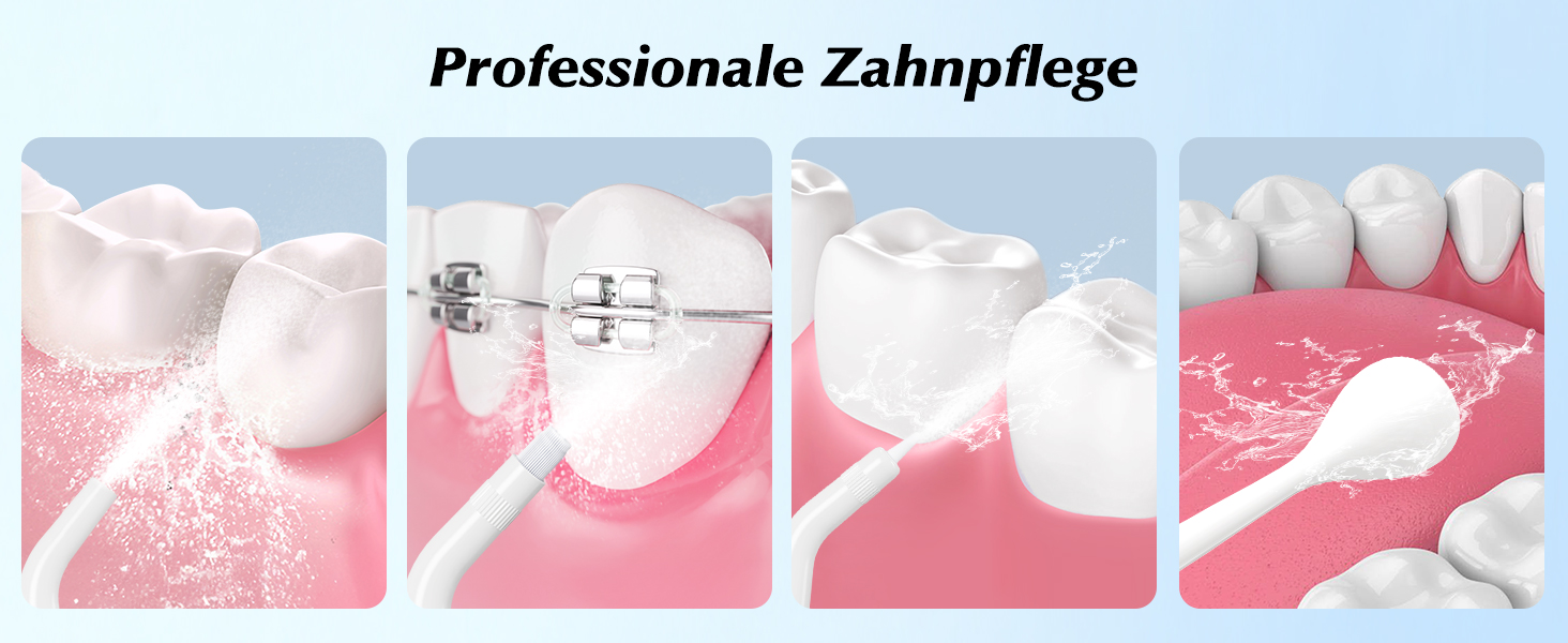 Електрична насадка для душу Munddusche: 5 струменів, 4 режими, для догляду за порожниною рота, водонепроникність IPX7, для дому та подорожей