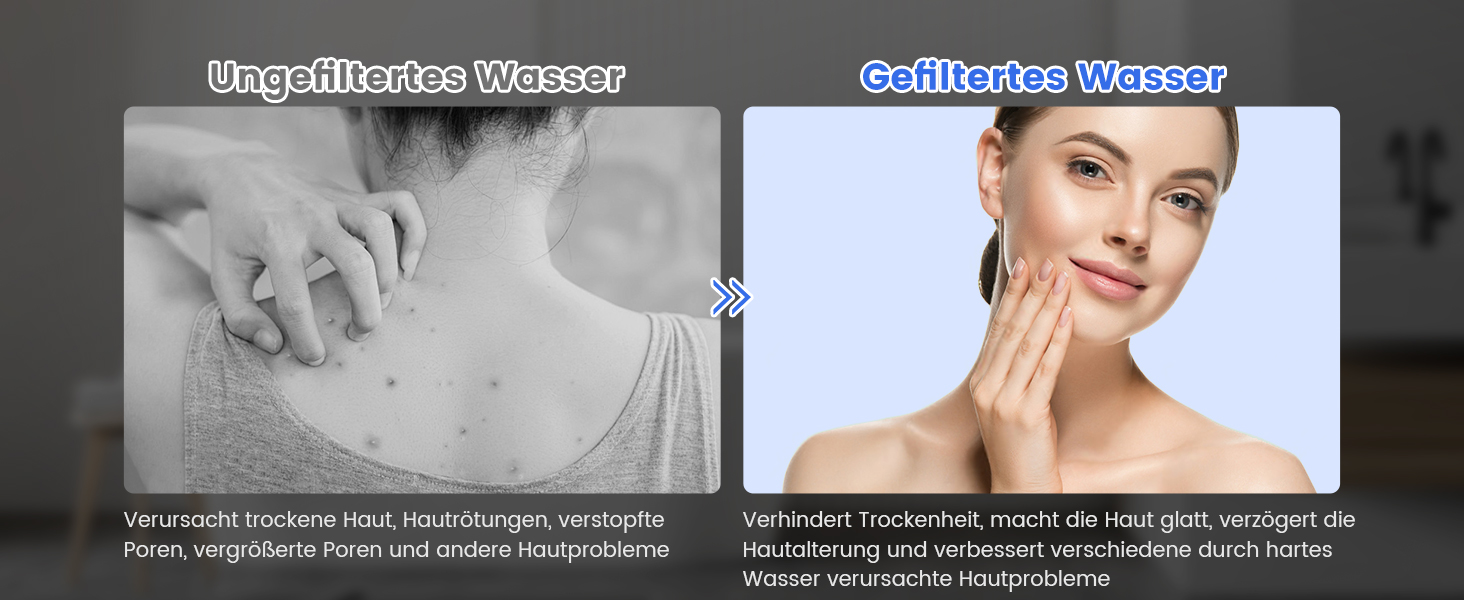 Фільтр для душу MEKO з високим тиском, ручна лійка з 15-шаровим фільтром, шланг 1,5 м, 3 режими, економія води, видаляє хлор, важку воду, важкі метали, темно-сірий